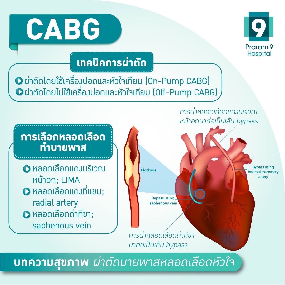 เทคนิคการทำ cabg