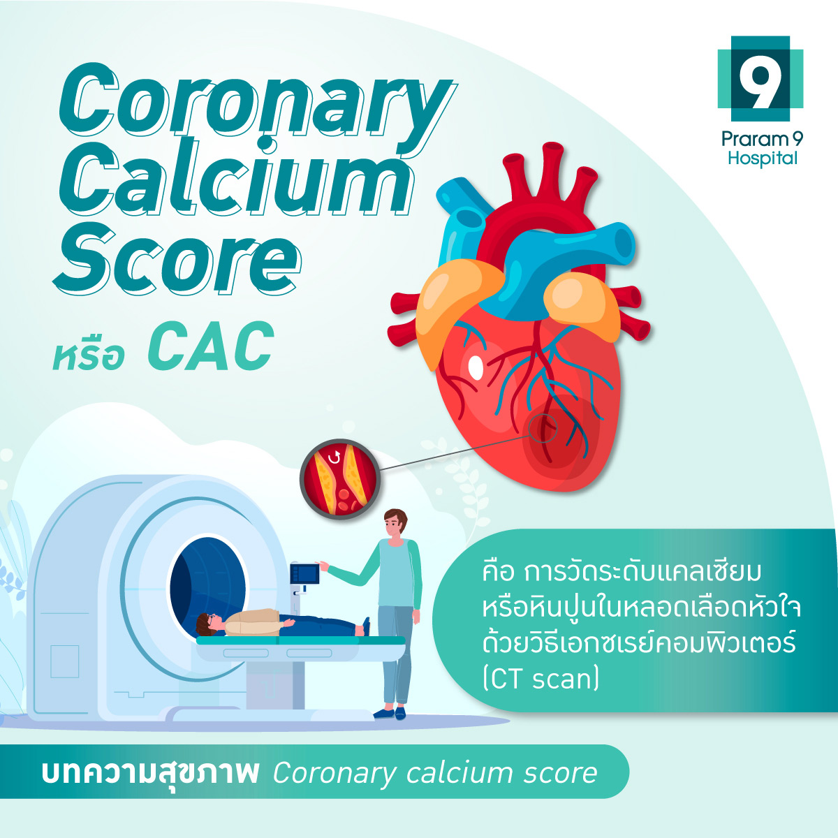 การตรวจ coronary calcium score (CAC)