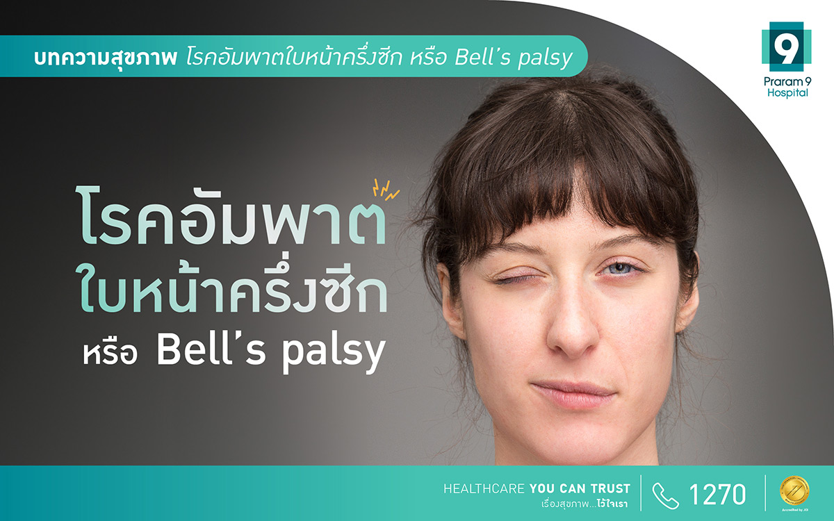 Bell’s palsy