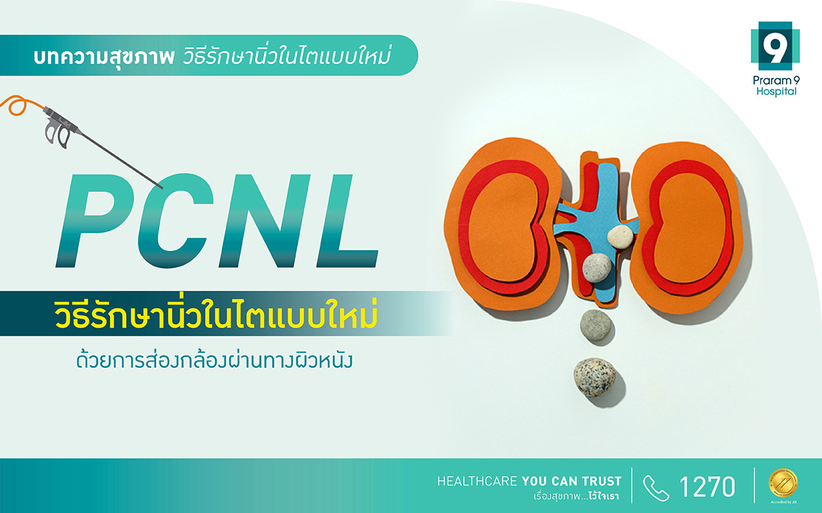 PCNL รักษานิ่วในไตแบบใหม่