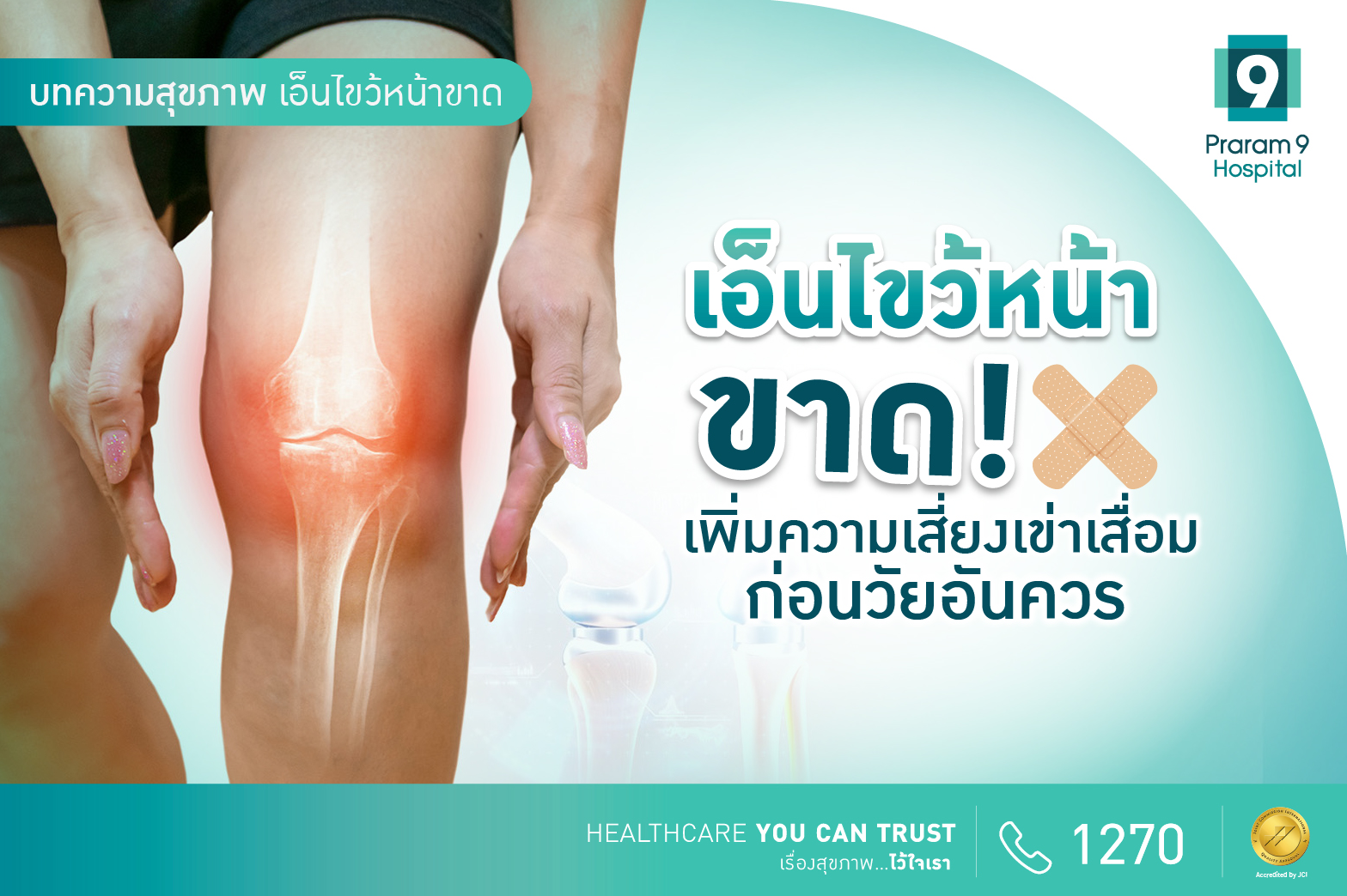 เอ็นไขว้หน้าขาด