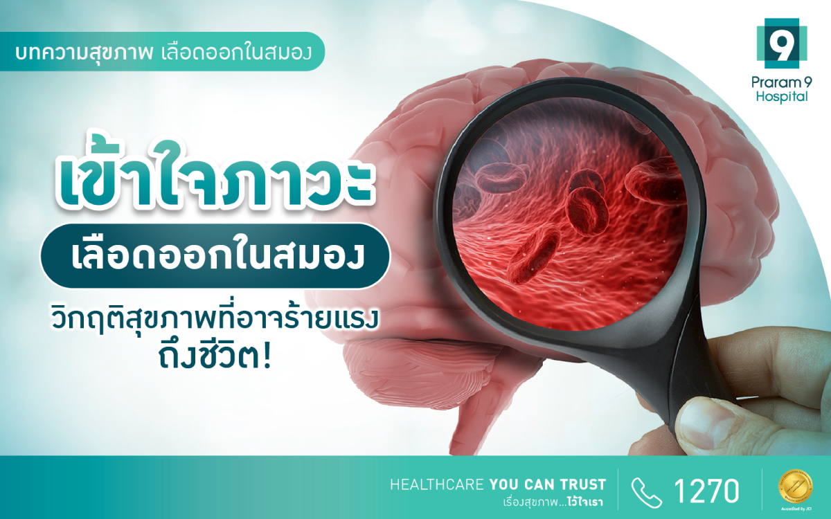 เลือดออกในสมอง