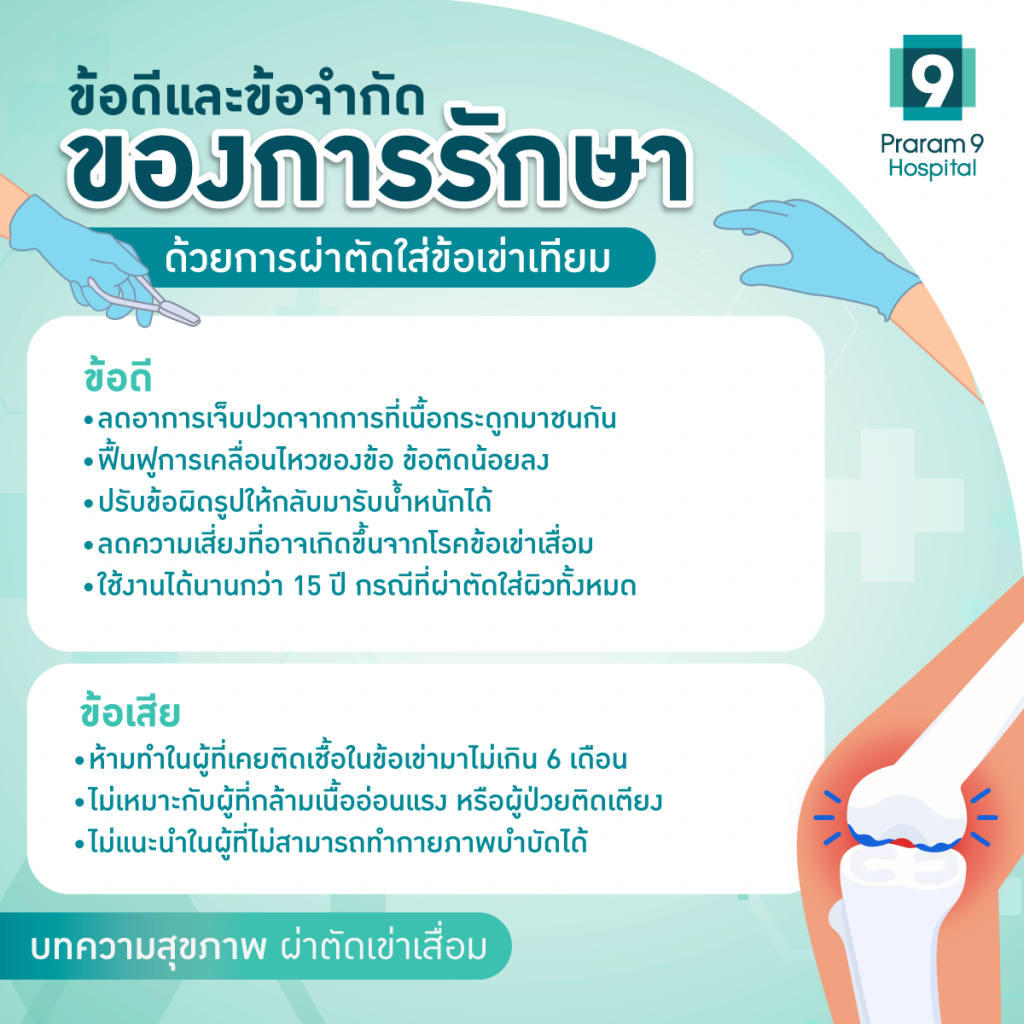 ผ่าตัดหัวเข่า