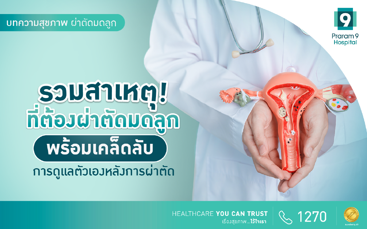 ผ่าตัดมดลูก