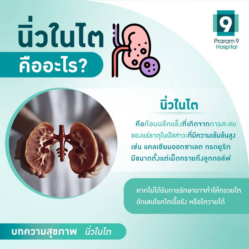 นิ่วในไตคืออะไร