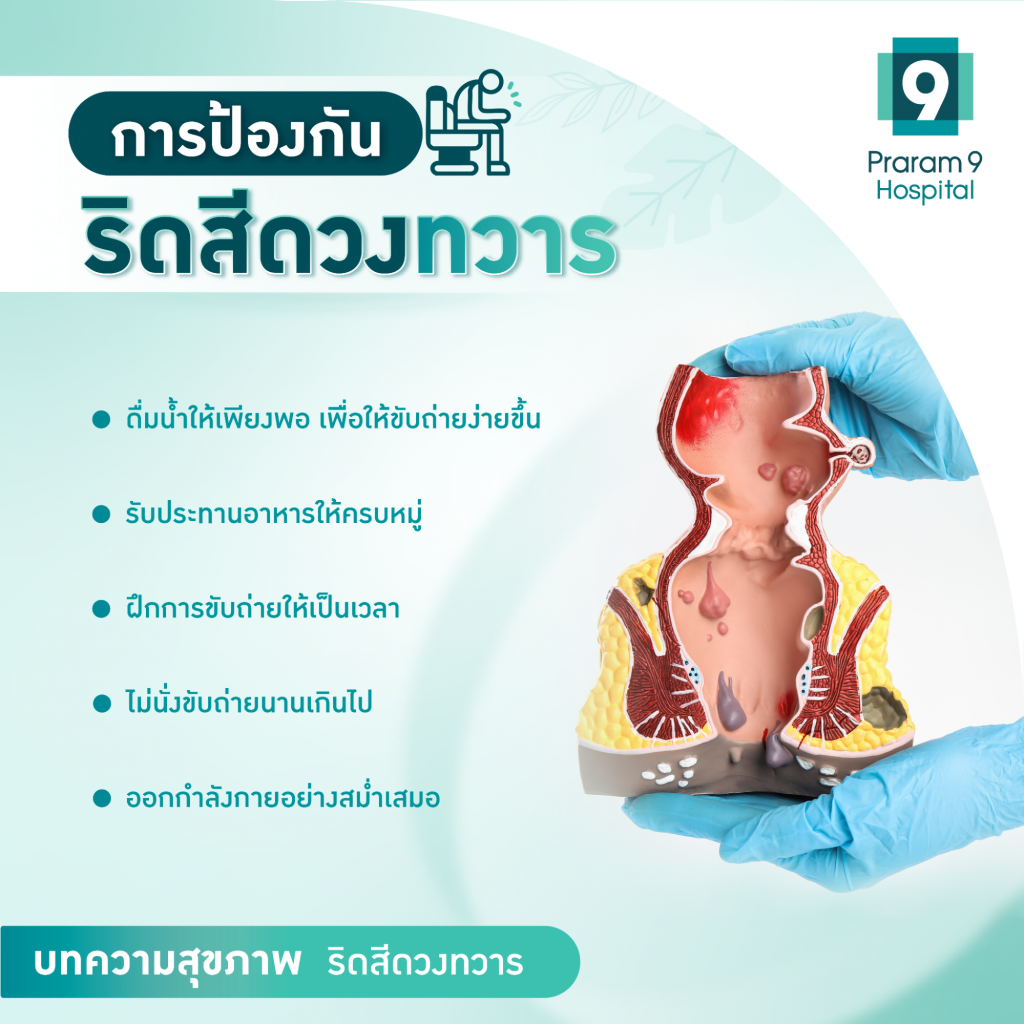 การป้องกันริดสีดวง